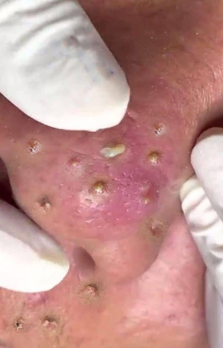 Peter Pan's Neverland Nightmare